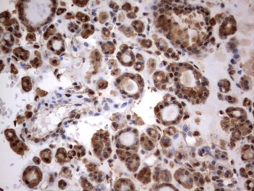 Monoclonal Mouse anti-Human HMBS / PBGD Antibody (clone UMAB144, Carrier-free, IHC, IF, WB)