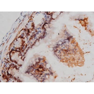 Polyclonal Rabbit anti-Human MAPT / Tau Antibody (phospho-Thr205, IHC, WB)
