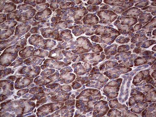 MTDH / Metadherin Antibody (aa70-582, clone OTI1H1)