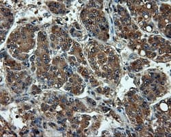 Monoclonal Mouse anti-Human LIPG / Endothelial Lipase Antibody (clone OTI3G7, IHC, WB)