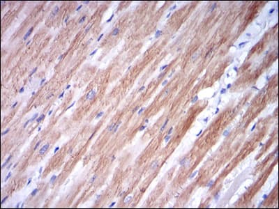 TNNI2 Antibody (clone 2F12A8)