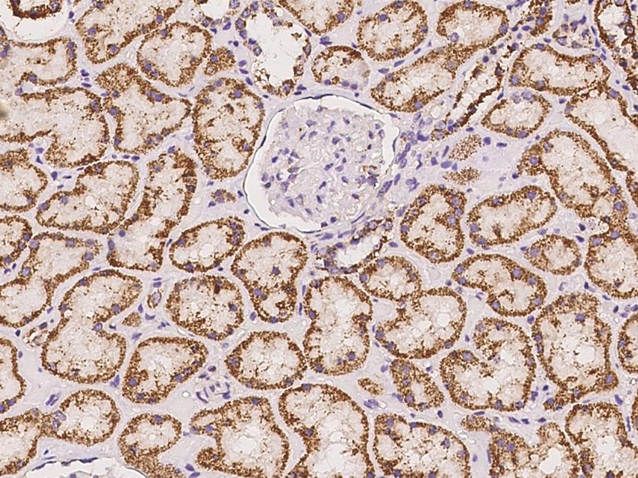 Polyclonal Rabbit anti-Human ALDH5A1 Antibody (IHC, IF)