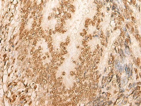 Polyclonal Rabbit anti-Human HIST1H2BA Antibody (IHC, WB)