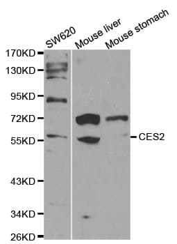 CES2 / Esterase Antibody