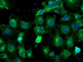 TUBAL3 Antibody (clone OTI4C5)
