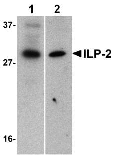 BIRC8 / ILP2 Antibody (aa2-13)