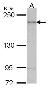Polyclonal Rabbit anti-Human CENTD2 / ARAP1 Antibody (aa1388-1450, WB)