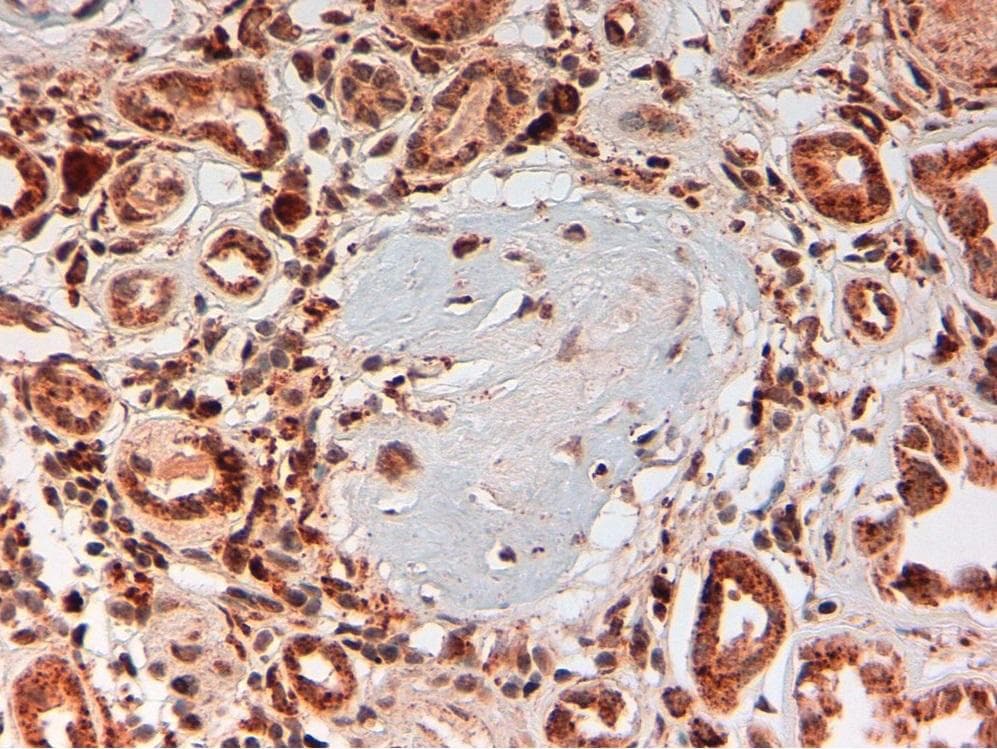 Complement C4d Antibody (clone LH61)
