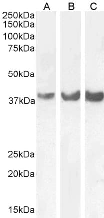 HOXD13 Antibody (Internal Region)