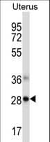 NDFIP1 / N4WBP5 Antibody (aa77-106)