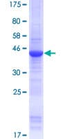 Human SPANXA1 Protein (Recombinant GST)
