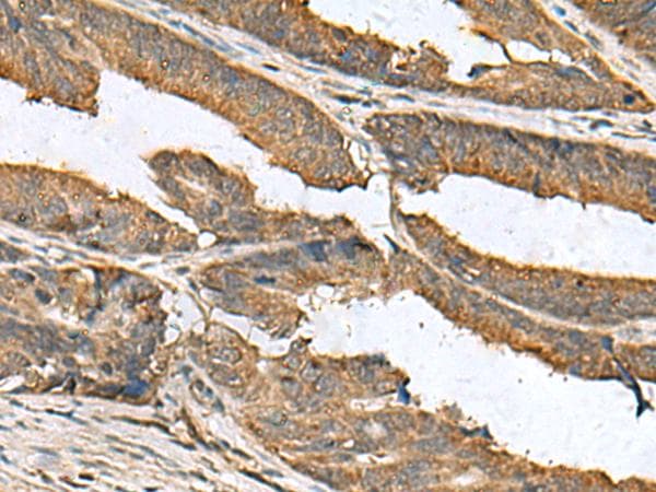 Polyclonal Rabbit anti-Human EIF1AX Antibody (IHC)