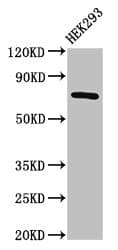 Polyclonal Rabbit anti-Human AACS Antibody (IHC, WB)