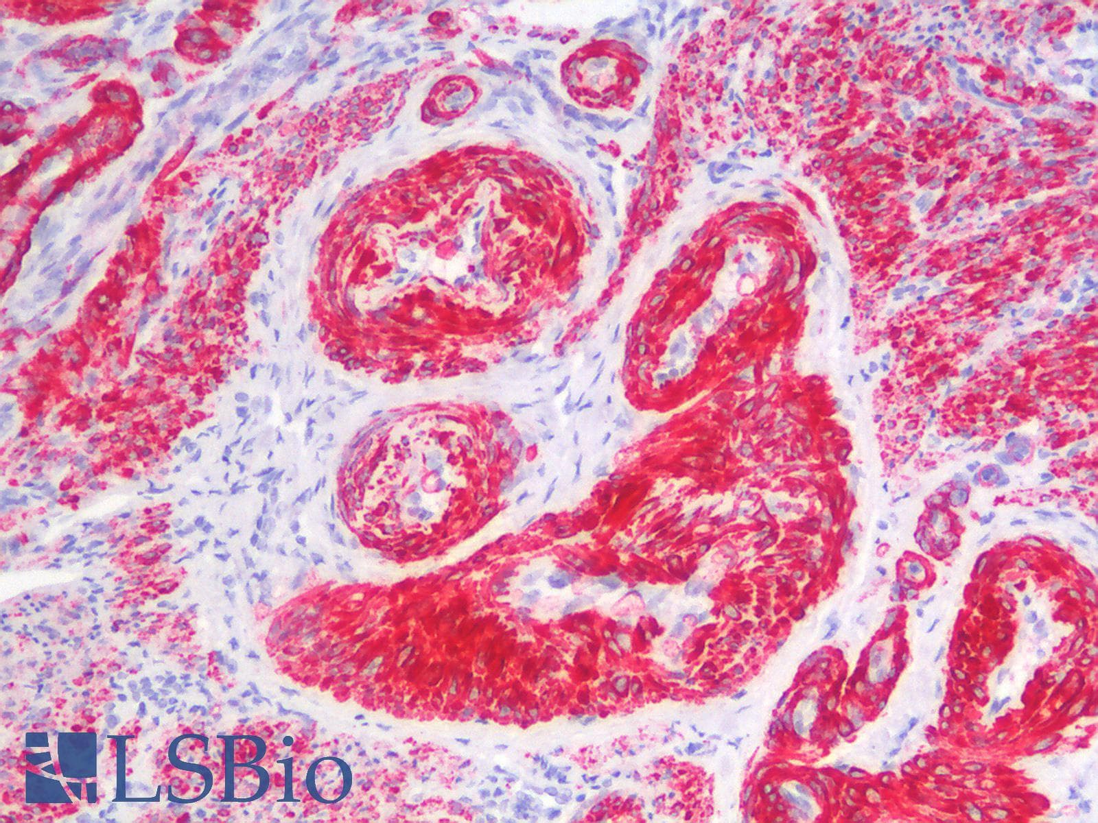 IHC-plus™ Recombinant Monoclonal Mouse anti-Human CALD1 / Caldesmon Antibody (clone rCALD1/820, IHC)