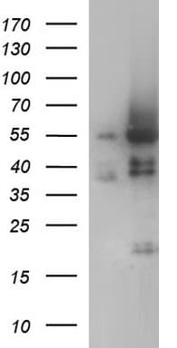 ANKMY2 Antibody (clone OTI1F11)