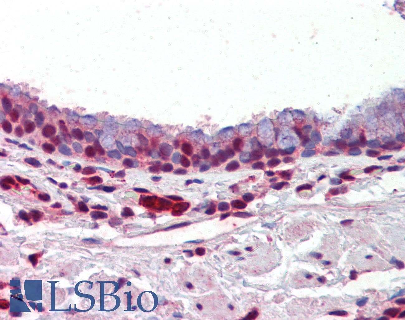 IHC-plus™ PRMT1 Antibody (aa317-346)