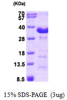 Human Junctin / ASPH Protein (Recombinant His)