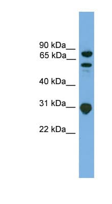 Polyclonal Rabbit anti-Human SH3KBP1 / CIN85 Antibody (aa107-156, WB)