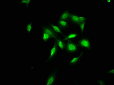 IHC-plus™ COL4A1 / Collagen IV Alpha1 Antibody (aa30-167)