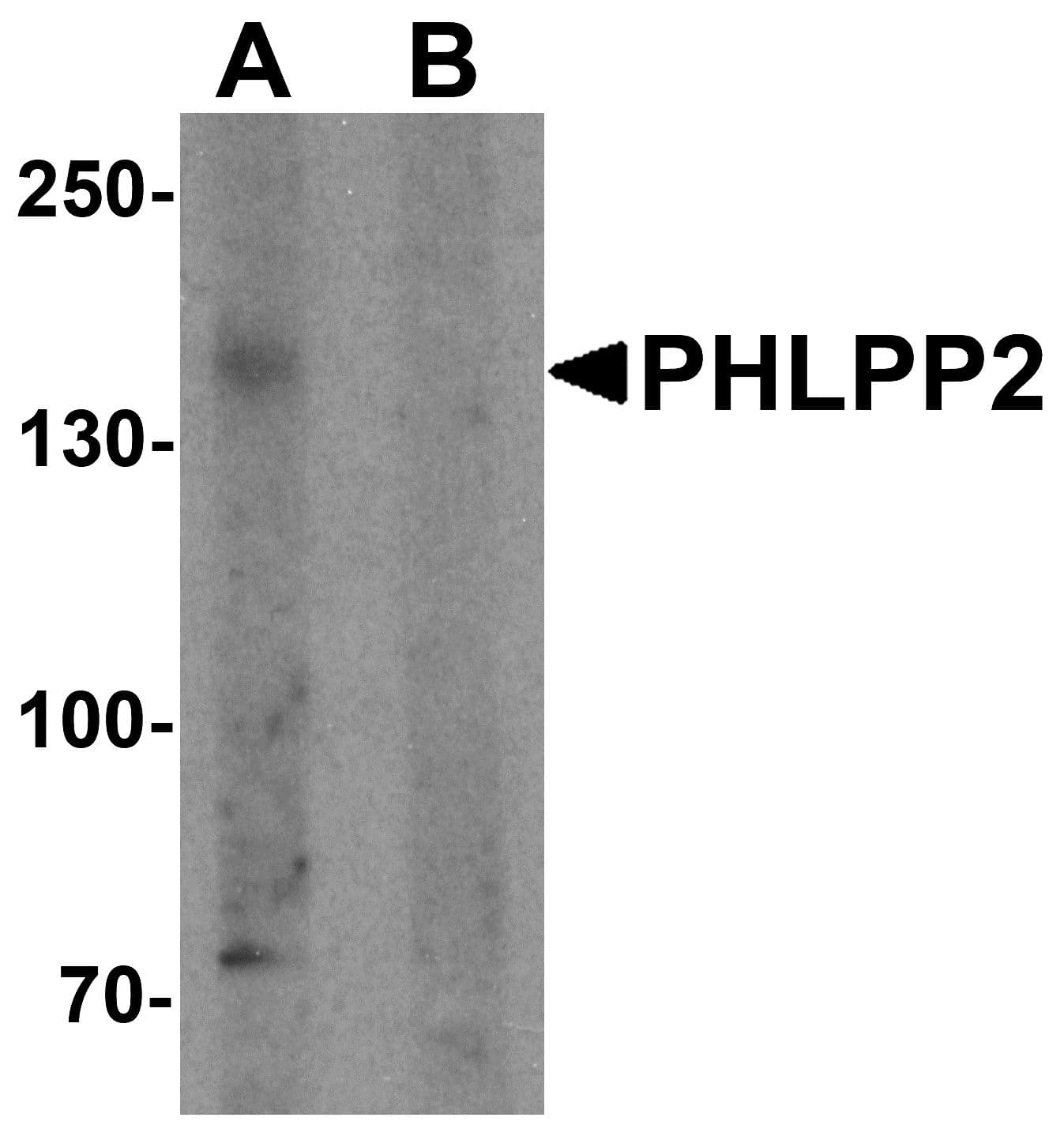 IHC-plus™ PHLPP2 / PHLPPL Antibody