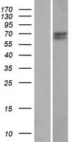 CCDC61 Protein (Over-Expression Lysate Myc-DDK (Flag))