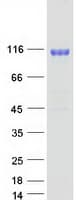 Human NCSTN / Nicastrin Protein (Recombinant Myc-DDK (Flag))