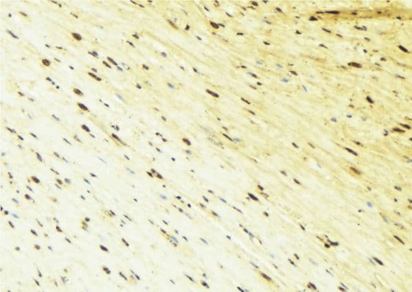 Polyclonal Rabbit anti-Human BAG3 / BAG-3 Antibody (IHC, WB)