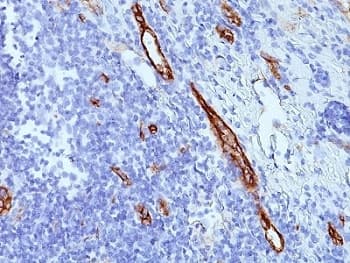 Monoclonal Mouse anti-Human VWF / Von Willebrand Factor Antibody (clone SPM577, IHC, IF, WB)