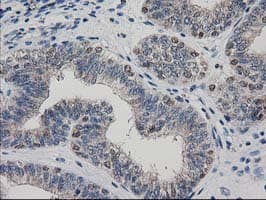 Monoclonal Mouse anti-Human ARFGAP1 Antibody (clone OTI1F6, IHC, IF, WB)