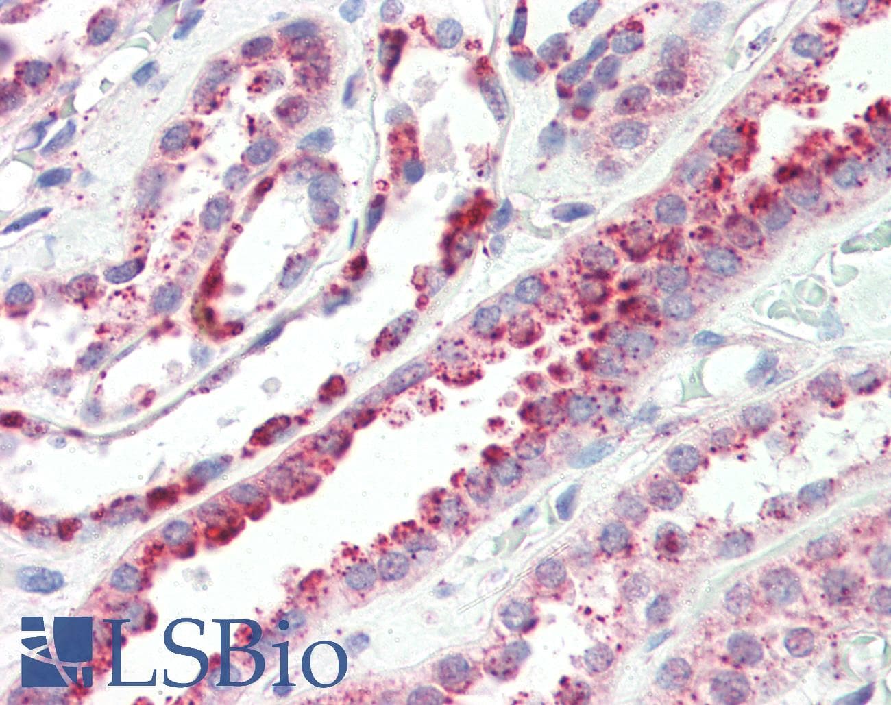 IHC-plus™ Polyclonal Rabbit anti-Human LIMPII / SCARB2 Antibody (IHC, IF, WB)