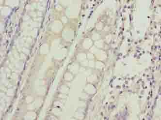 HIGD1B Antibody