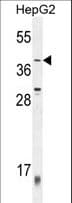 ZNF763 Antibody (aa359-387)