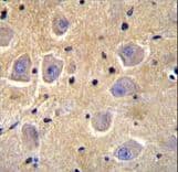 SHISA6 Antibody (aa81-109)