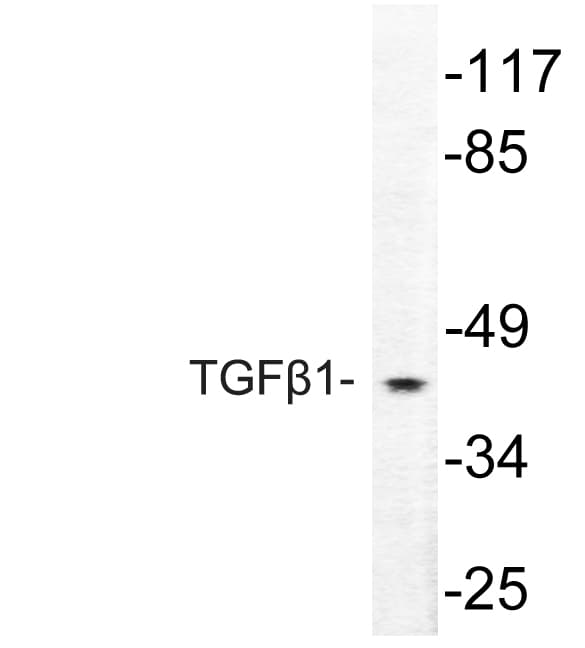 Polyclonal Rabbit anti-Human TGFB1 / TGF Beta 1 Antibody (Tyr369, IHC, IF, WB)