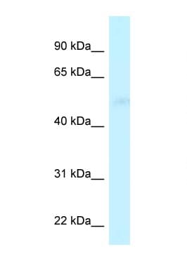 Polyclonal Rabbit anti-Human CPVL Antibody (aa231-280, IHC, WB)