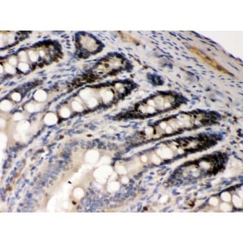 AIM2 Antibody (aa14-215)