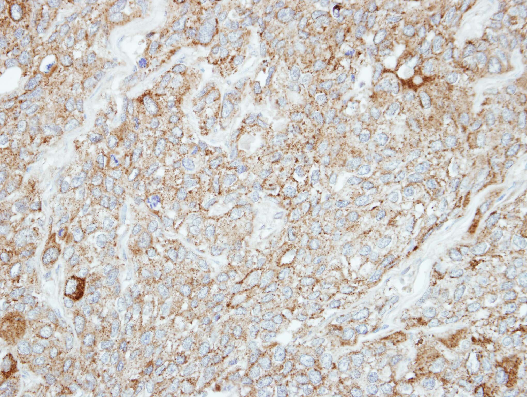 Polyclonal Rabbit anti-Human PCDH1 / PCD1 Antibody (aa710-971, IHC, WB)