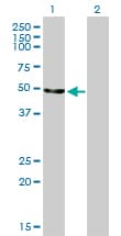 ENO2 / NSE Antibody (clone 1A3)