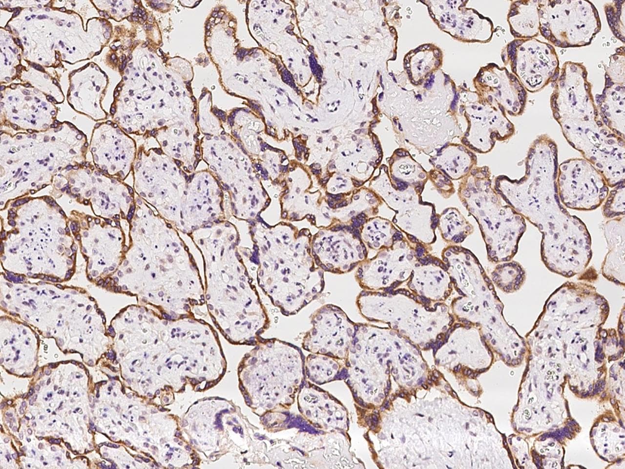 Polyclonal Rabbit anti-Human CYTIP Antibody (IHC, IF)