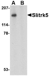 SLITRK5 Antibody
