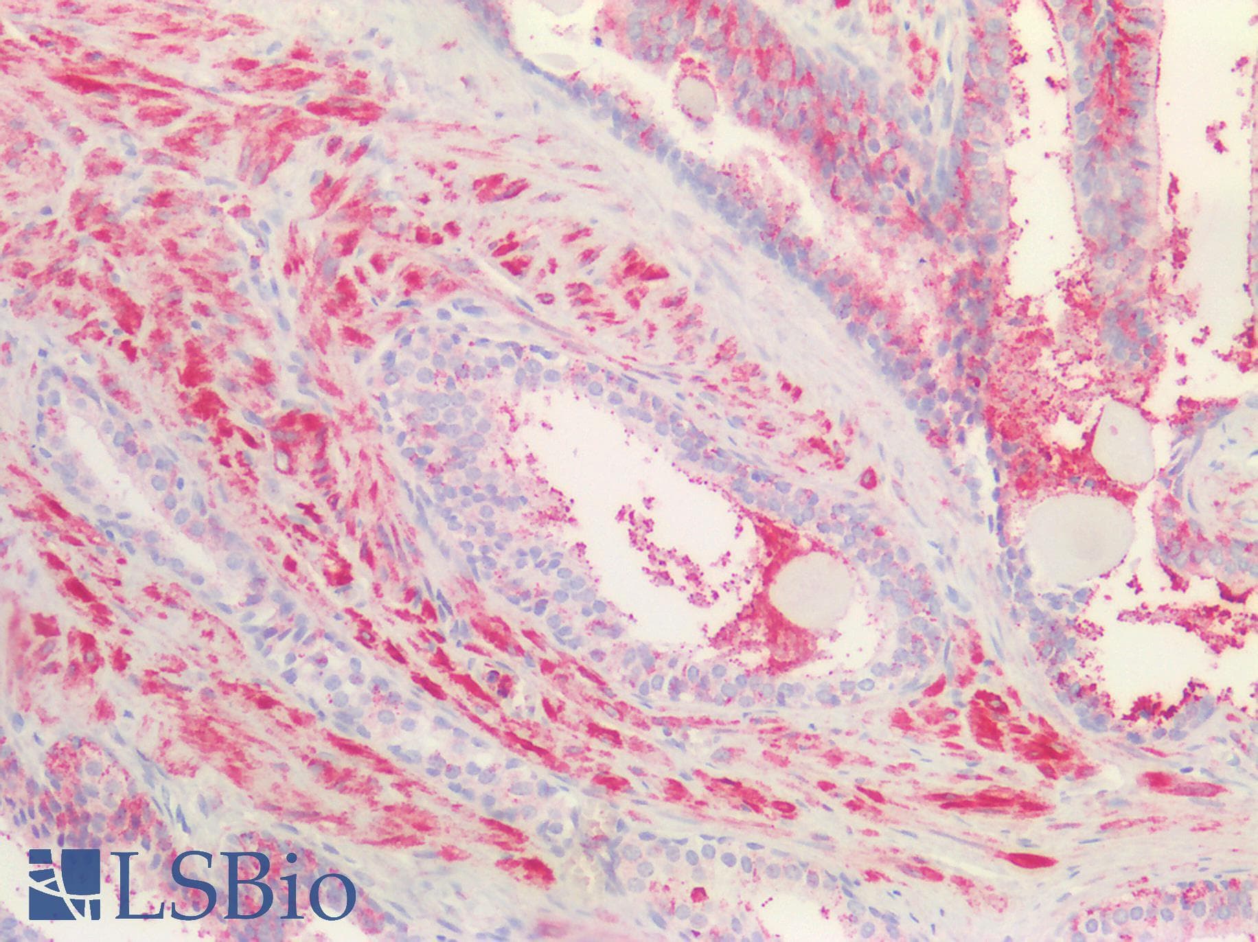 Polyclonal Rabbit anti-Rat KLK4 / Kallikrein 4 Antibody (aa32-256, IHC, WB)