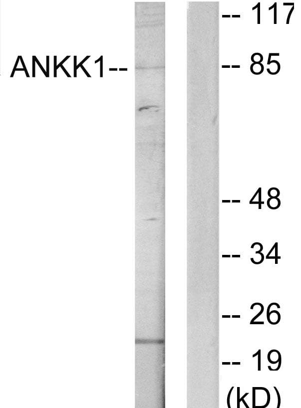 Polyclonal Rabbit anti-Human ANKK1 Antibody (WB)