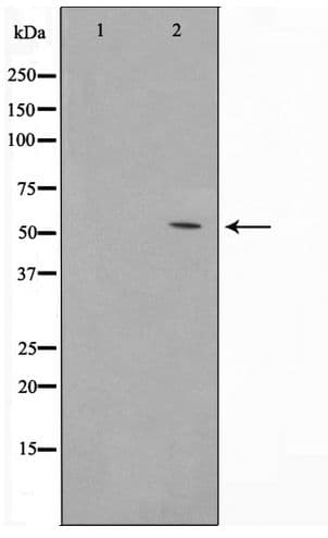 TINF2 Antibody