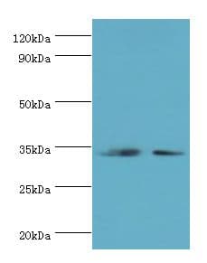 Polyclonal Rabbit anti-Human RPH3AL Antibody (aa161-315, IHC, WB)