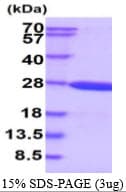 Human CRYGS Protein (Recombinant His)