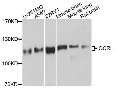 Polyclonal Rabbit anti-Human OCRL Antibody (WB)