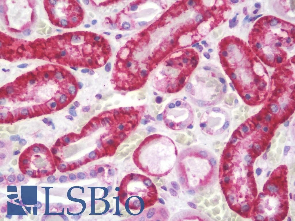IHC-plus™ Polyclonal Rabbit anti-Human CDH16 / Cadherin 16 Antibody (aa796-824, IHC, WB)