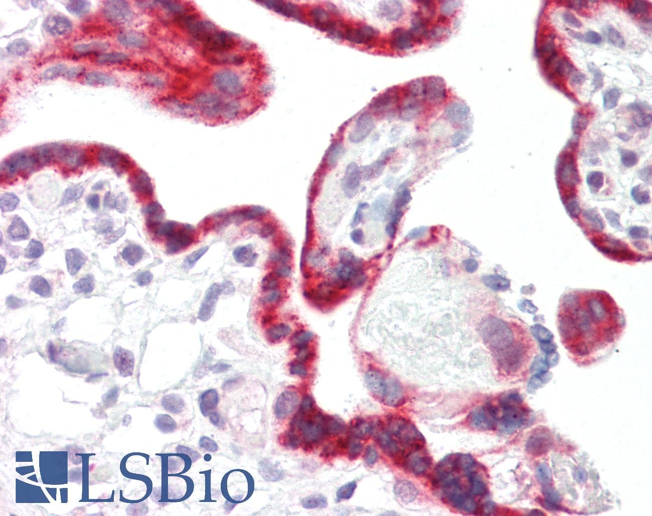 PRKCSH Antibody (aa155-204)