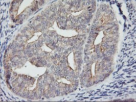 RTN4IP1 / NIMP Antibody (aa41-279, clone OTI1A8)