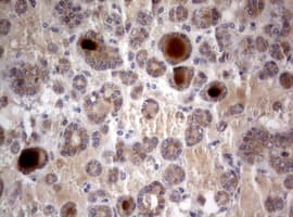 PIK3C2A Antibody (aa230-560, clone OTI2C2)